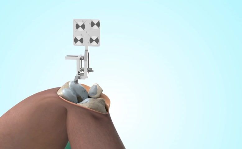 Medical Device & Surgery Equipment