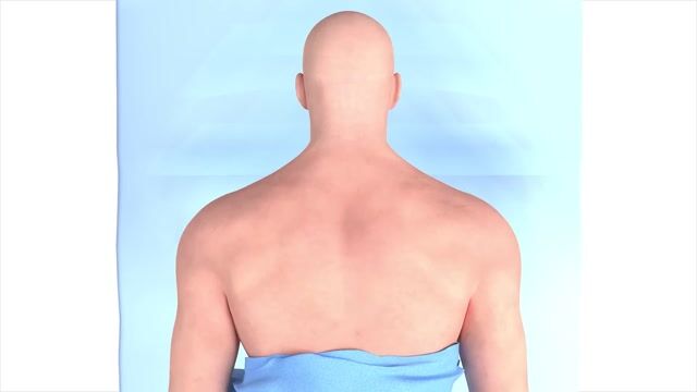 Craniectomy Brain Surgery