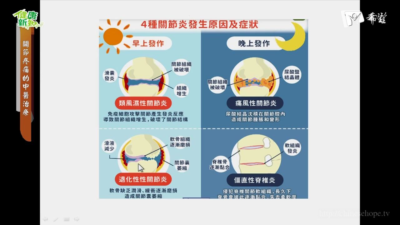 1010.退化性膝關節炎的中醫治療