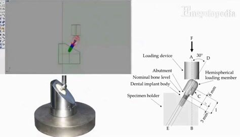 Finite Element Analysis in Implantology