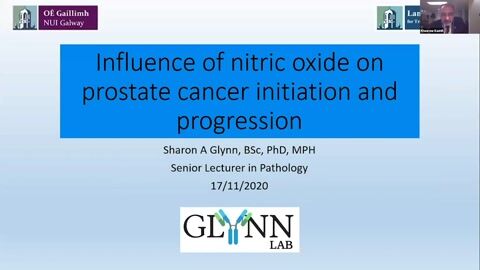 Nitric Oxide impacts prostate cancer