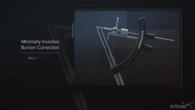 Arthrex Minimally Invasive Bunionectomy System