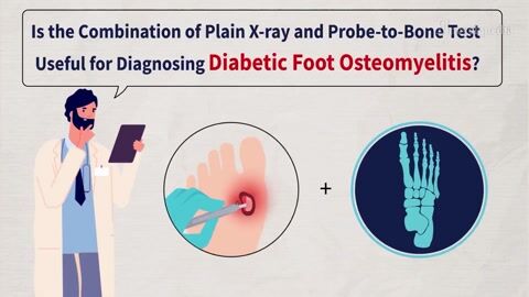 Encyclopedia-Combination of Plain X-ray and Probe-to-Bone for Diagnosing Diabetic Foot Osteomyelitis