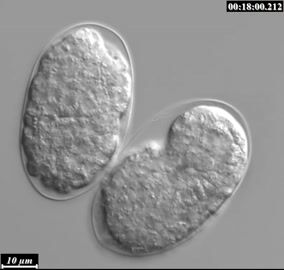 Time-Lapse of Live Developmental Apoptosis in C.elegans Embryogenesis