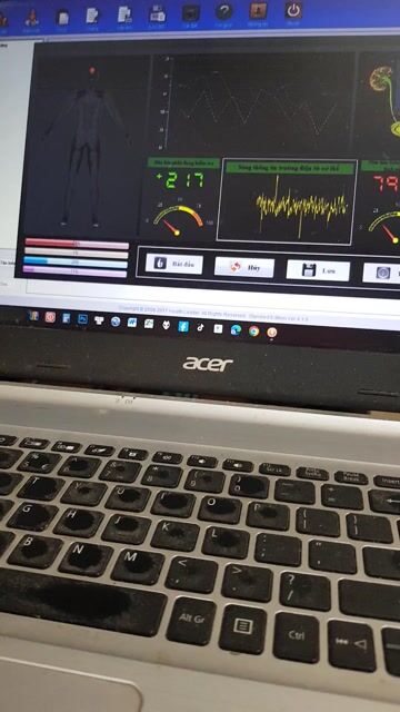 Máy kiểm tra sức khoẻ lượng tử sinh học Quantum. Mua bán Đồ chuyên dụng, Giống nuôi trồng tại Quận Hai Bà Trưng Hà Nội được đăng bởi OpenSky hình 1