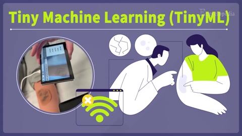Encyclopedia-Diagnosing Skin Diseases with TinyML on Low-Spec Devices