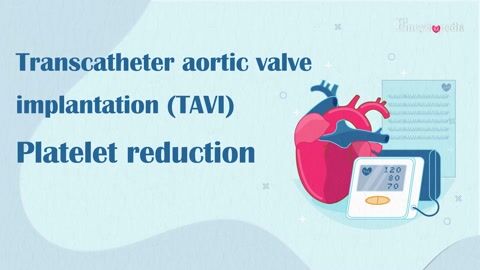 Encyclopedia-Platelet Reduction after Transcatheter Aortic Valve Implantation