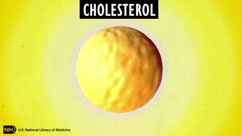 Cholesterol Good and Bad