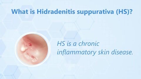 CSCC in Patients with Hidradenitis Suppurativa